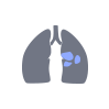 icon of Lung Cancer Center