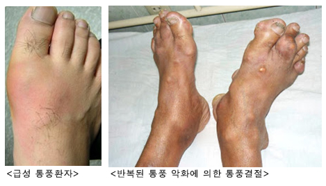 this is image of foot