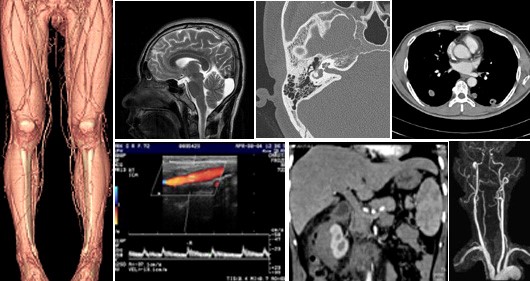 medical image