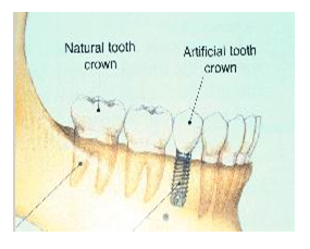 tooth image